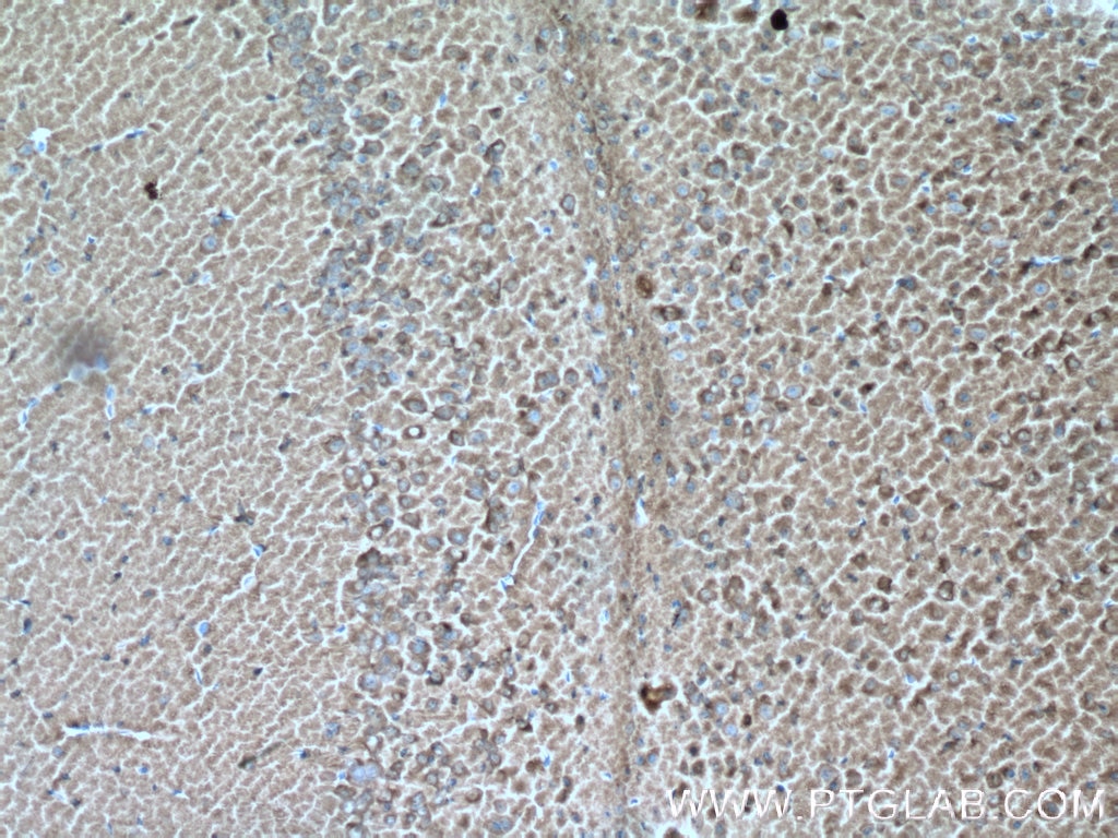 IHC staining of mouse brain using 66120-1-Ig