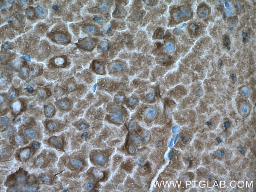 IHC staining of mouse brain using 66120-1-Ig
