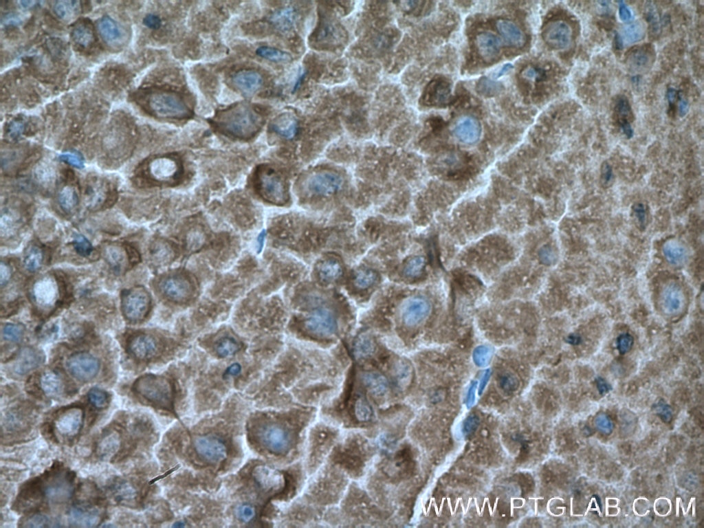 Immunohistochemistry (IHC) staining of mouse brain tissue using Aldolase C Monoclonal antibody (66120-1-Ig)