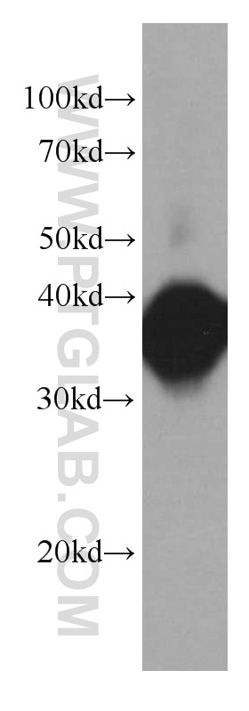 Western Blot (WB) analysis of human brain tissue using Aldolase C Monoclonal antibody (66120-1-Ig)