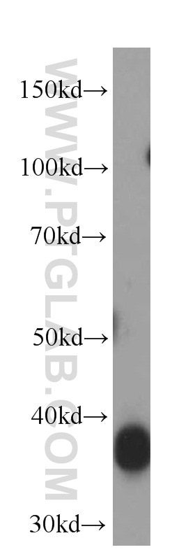 Western Blot (WB) analysis of human heart tissue using Aldolase C Monoclonal antibody (66120-1-Ig)