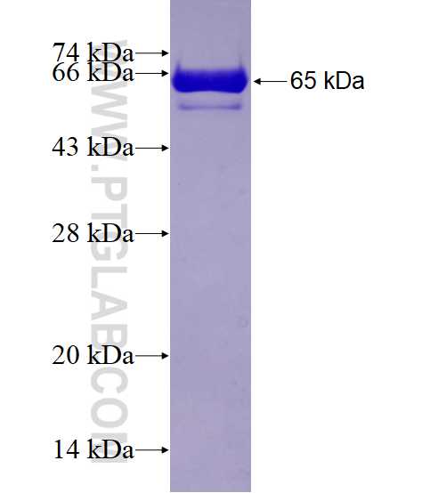 ALDOC fusion protein Ag6659 SDS-PAGE