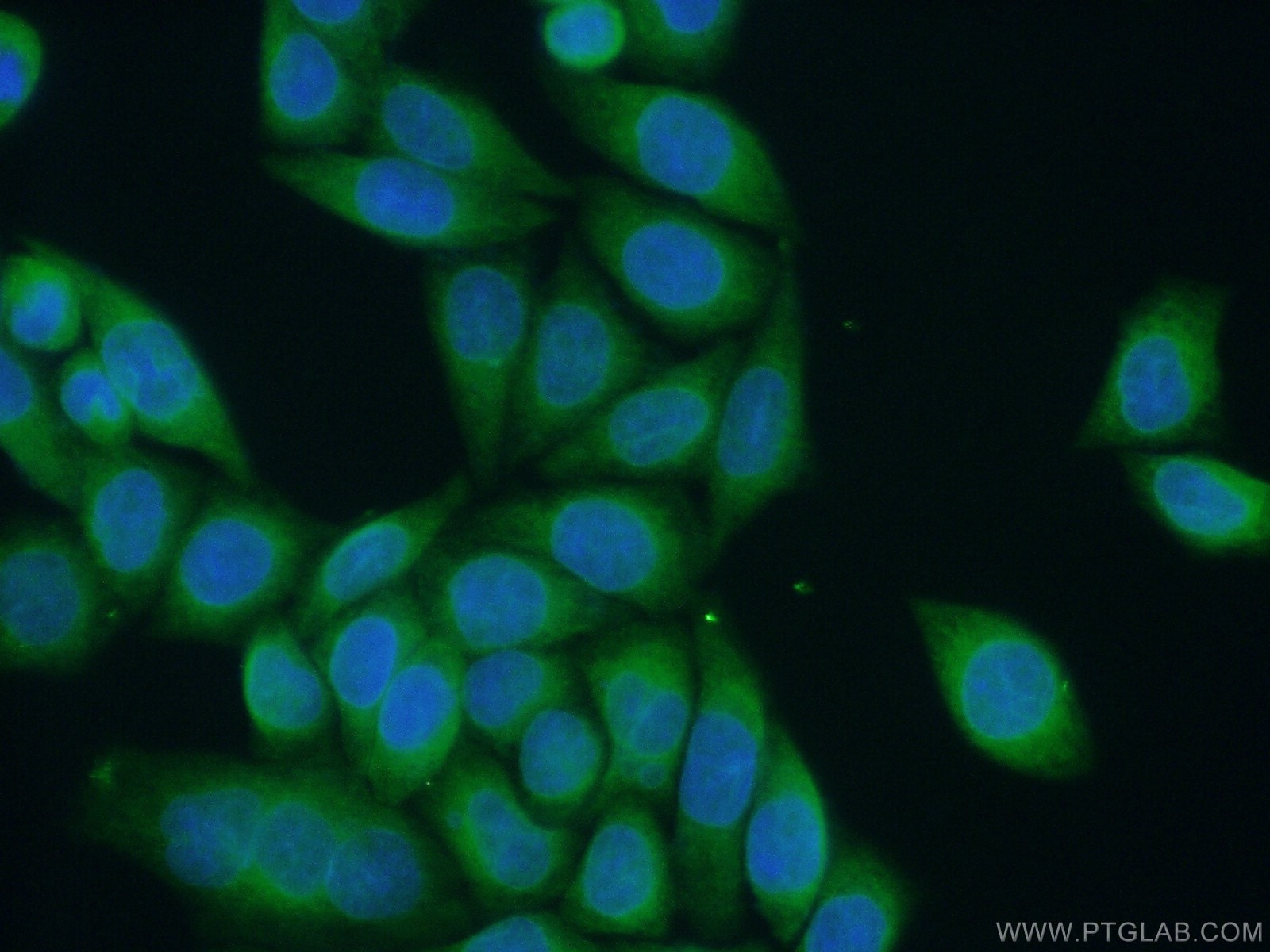 Immunofluorescence (IF) / fluorescent staining of HeLa cells using ALG1 Polyclonal antibody (12872-1-AP)