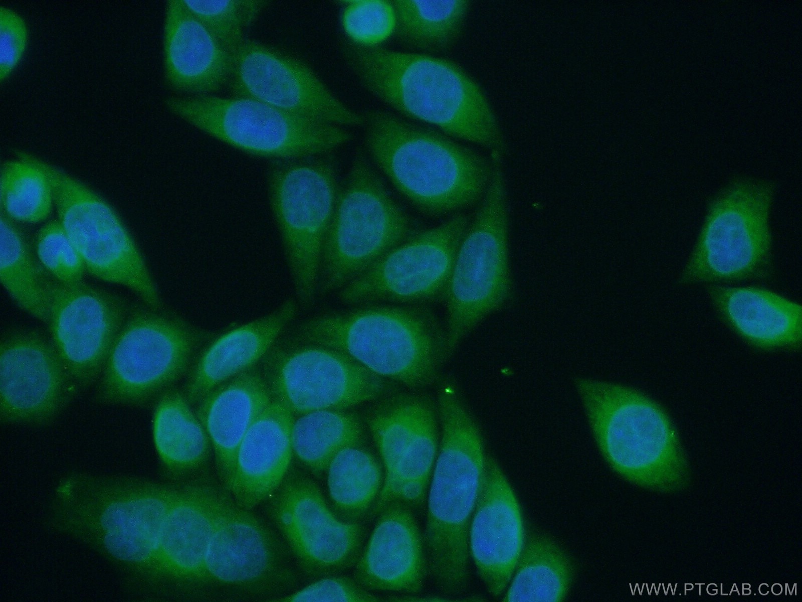 IF Staining of HeLa using 12872-1-AP