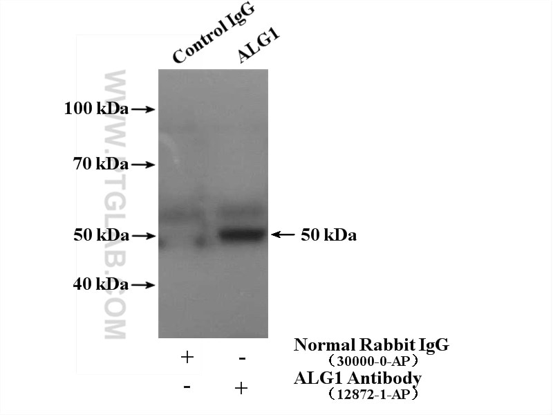 Immunoprecipitation (IP) experiment of HeLa cells using ALG1 Polyclonal antibody (12872-1-AP)