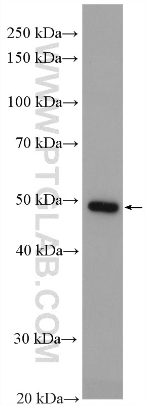 Western Blot (WB) analysis of HeLa cells using ALG1 Polyclonal antibody (12872-1-AP)