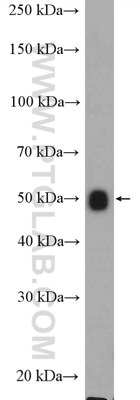 Western Blot (WB) analysis of rat brain tissue using ALG11 Polyclonal antibody (27085-1-AP)