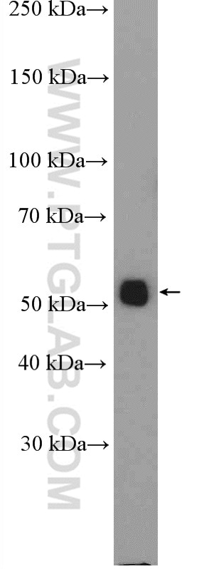 Western Blot (WB) analysis of mouse brain tissue using ALG11 Polyclonal antibody (27085-1-AP)