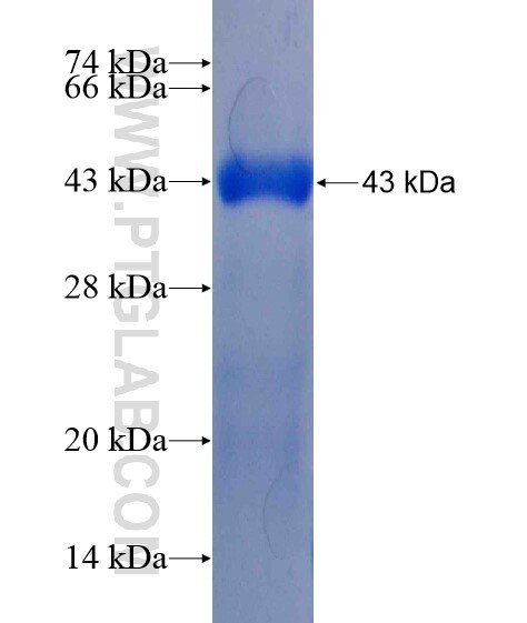 ALG11 fusion protein Ag21123 SDS-PAGE