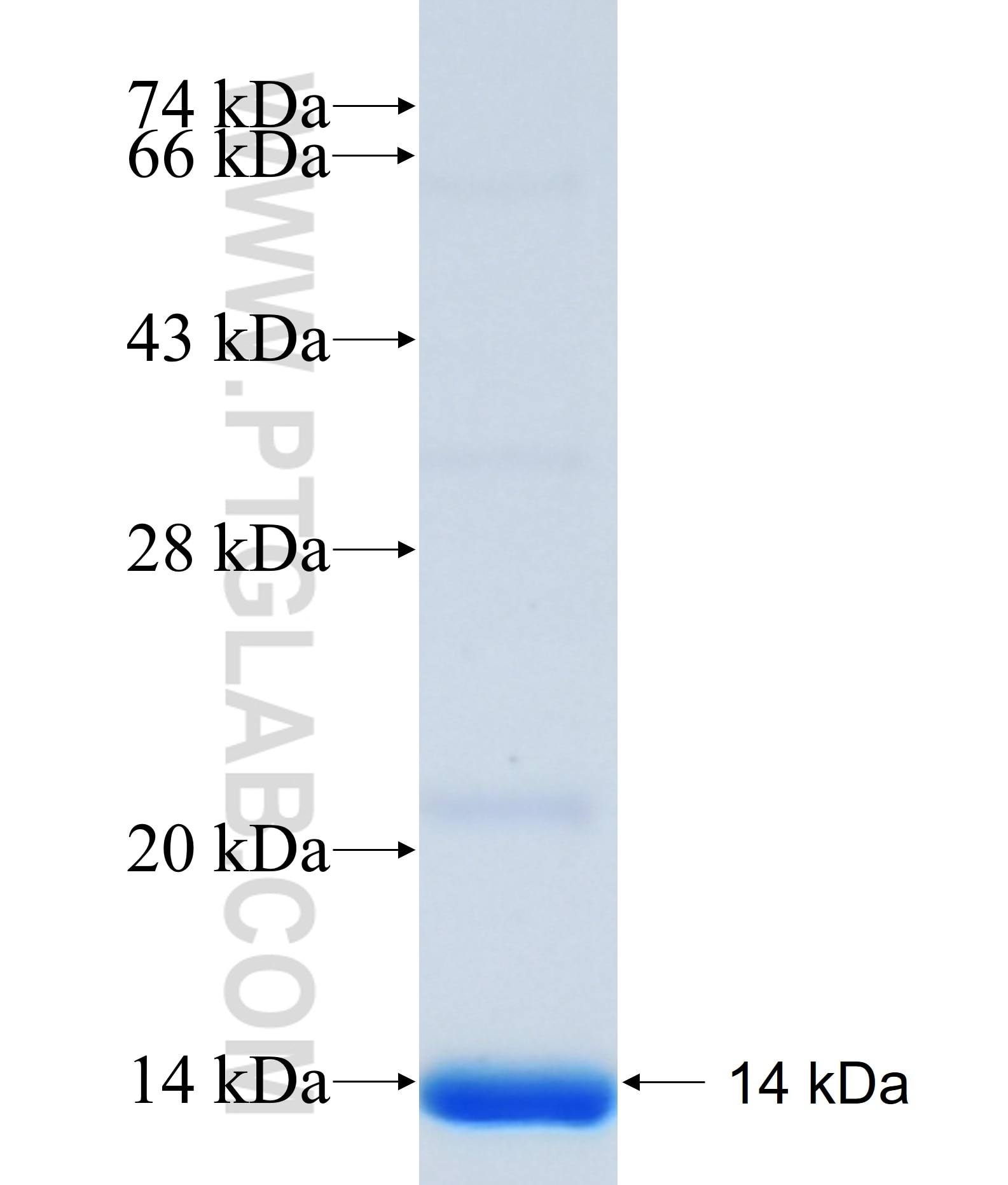 ALG12 fusion protein Ag37008 SDS-PAGE ALG12 fusion protein Ag37008 SDS-PAGE