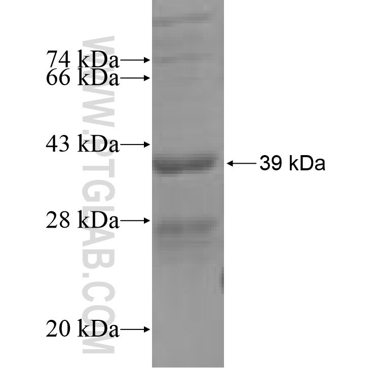 ALG12 fusion protein Ag7201 SDS-PAGE