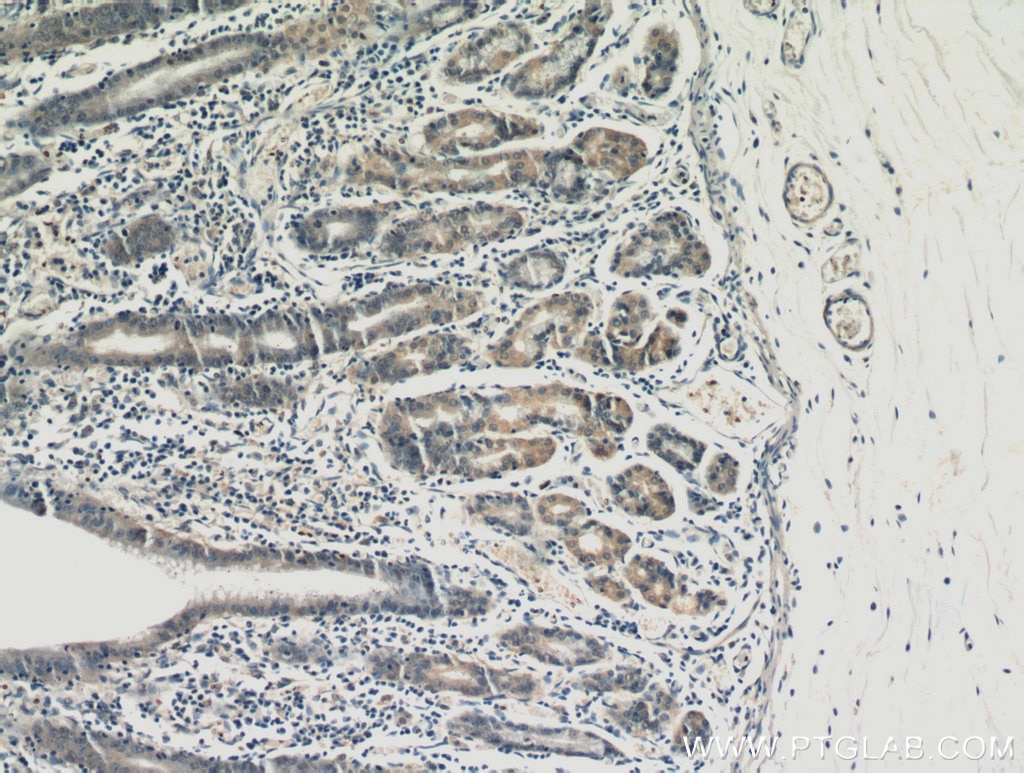 Immunohistochemistry (IHC) staining of human stomach tissue using ALG13 Polyclonal antibody (20810-1-AP)