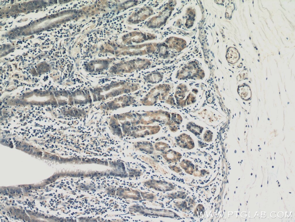 IHC staining of human stomach using 20810-1-AP