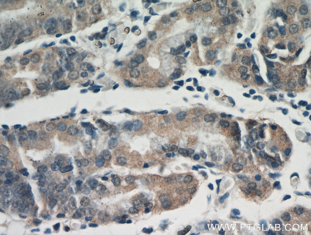 IHC staining of human stomach using 20810-1-AP