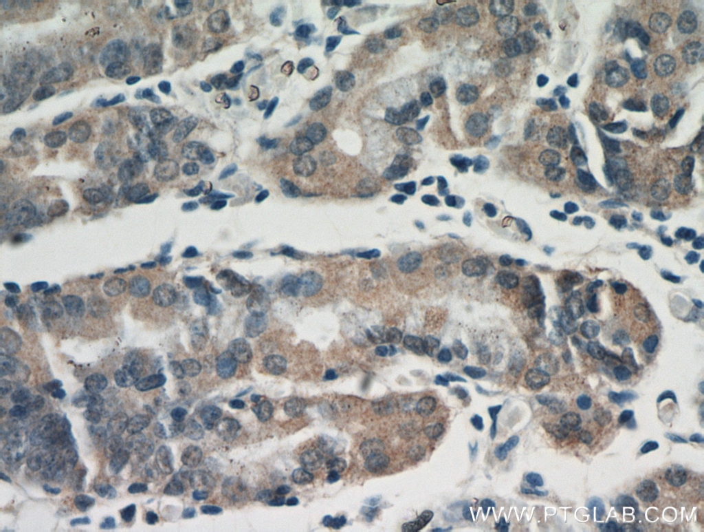 Immunohistochemistry (IHC) staining of human stomach tissue using ALG13 Polyclonal antibody (20810-1-AP)