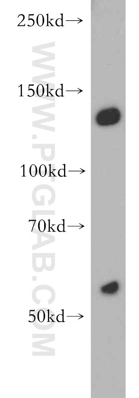 Western Blot (WB) analysis of K-562 cells using ALG13 Polyclonal antibody (20810-1-AP)