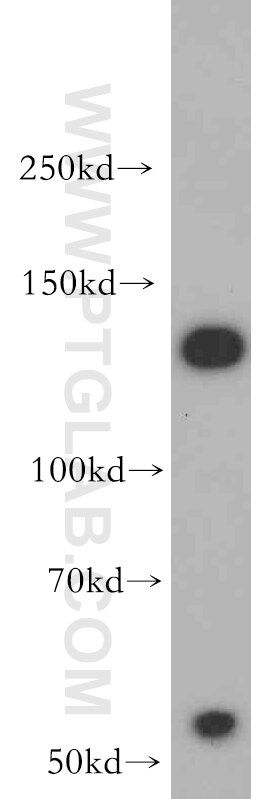 Western Blot (WB) analysis of HepG2 cells using ALG13 Polyclonal antibody (20810-1-AP)