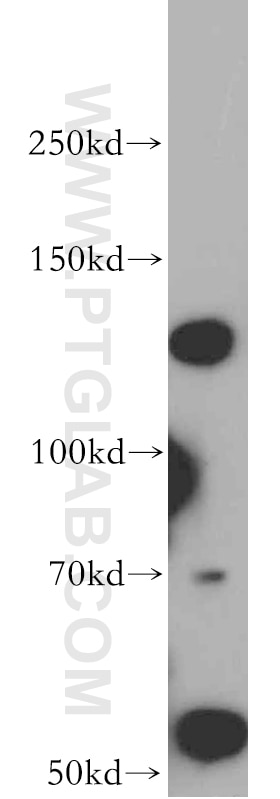 Western Blot (WB) analysis of Jurkat cells using ALG13 Polyclonal antibody (20810-1-AP)