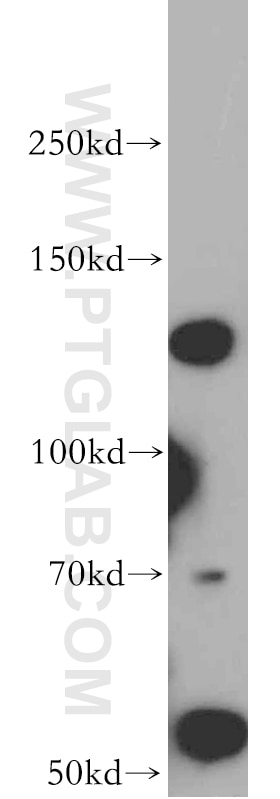 WB analysis of Jurkat using 20810-1-AP