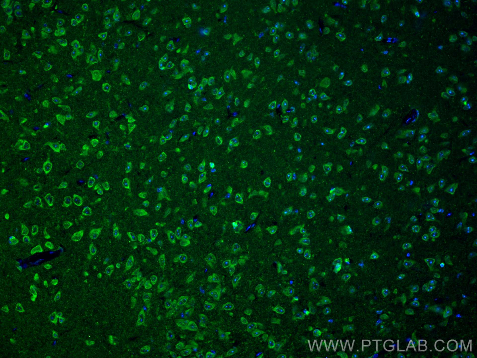 Immunofluorescence (IF) / fluorescent staining of mouse brain tissue using ALG13 Polyclonal antibody (28738-1-AP)