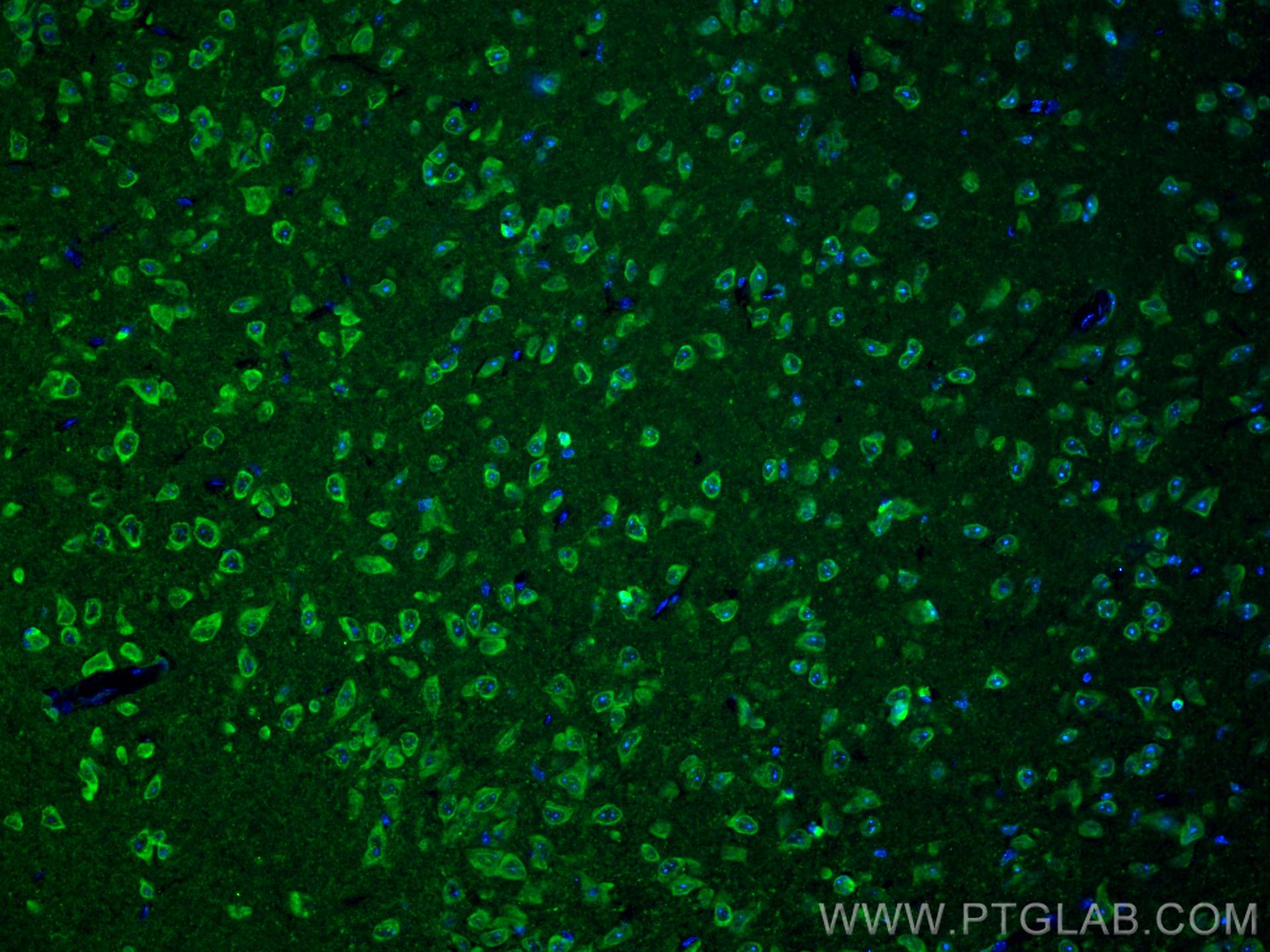 IF Staining of mouse brain using 28738-1-AP