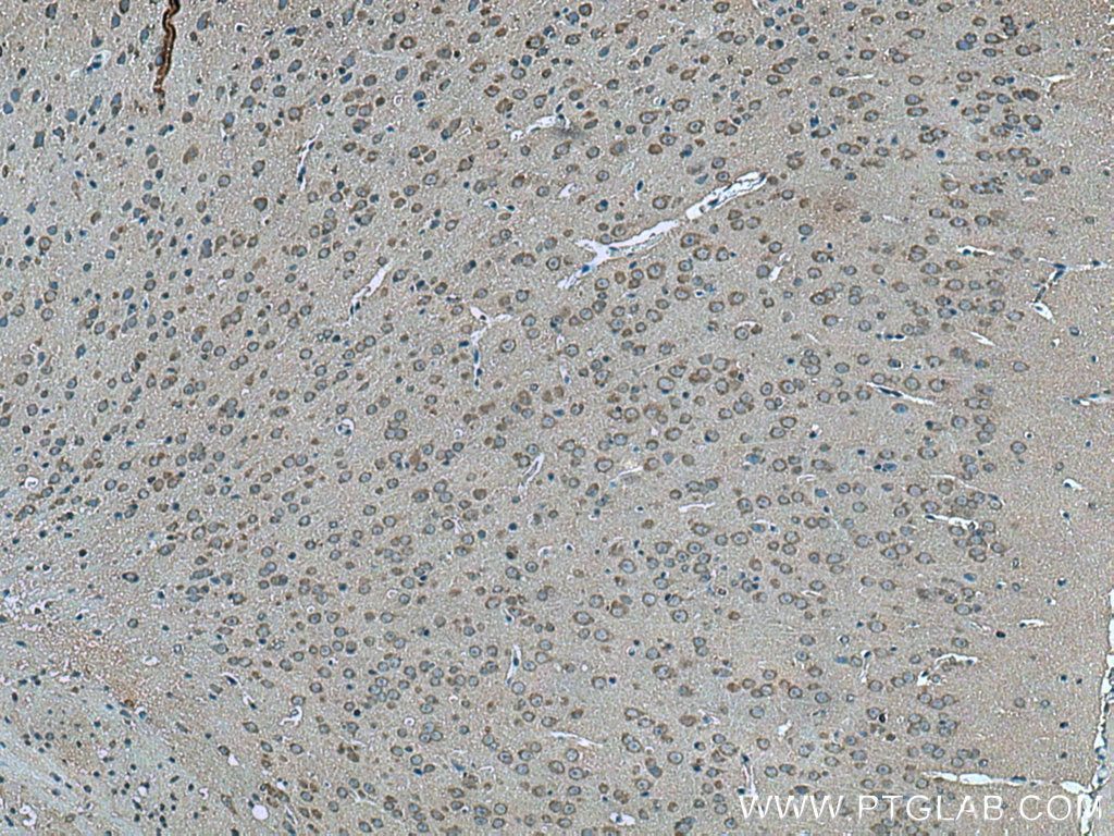 Immunohistochemistry (IHC) staining of mouse brain tissue using ALG13 Polyclonal antibody (28738-1-AP)