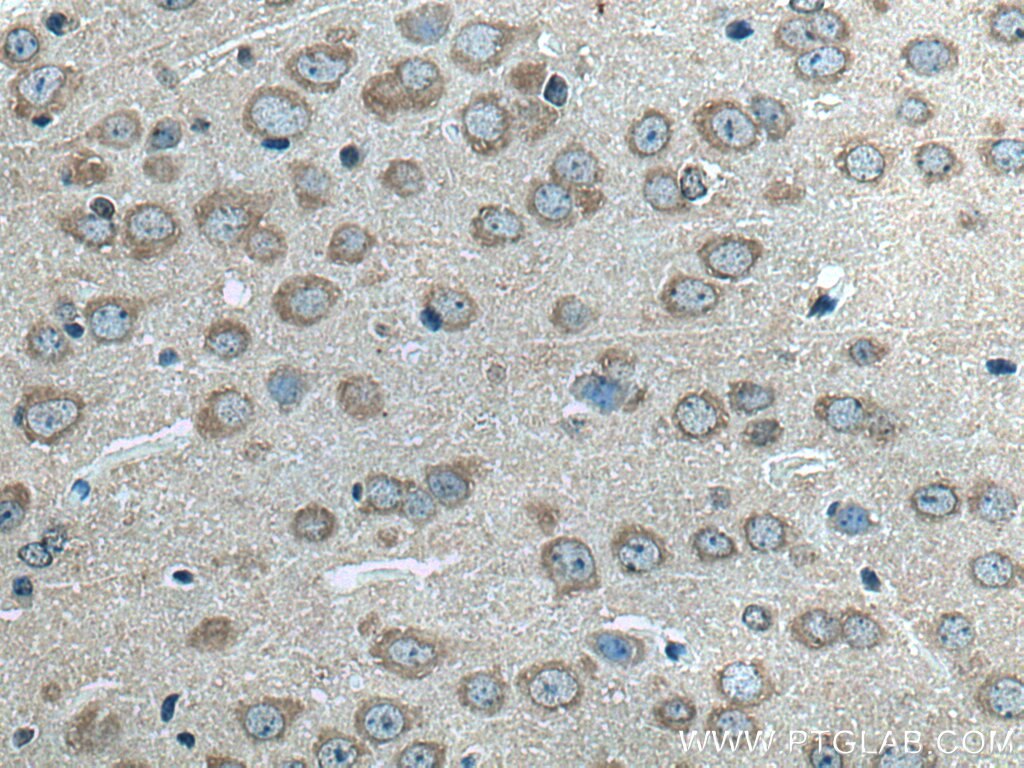 Immunohistochemistry (IHC) staining of mouse brain tissue using ALG13 Polyclonal antibody (28738-1-AP)