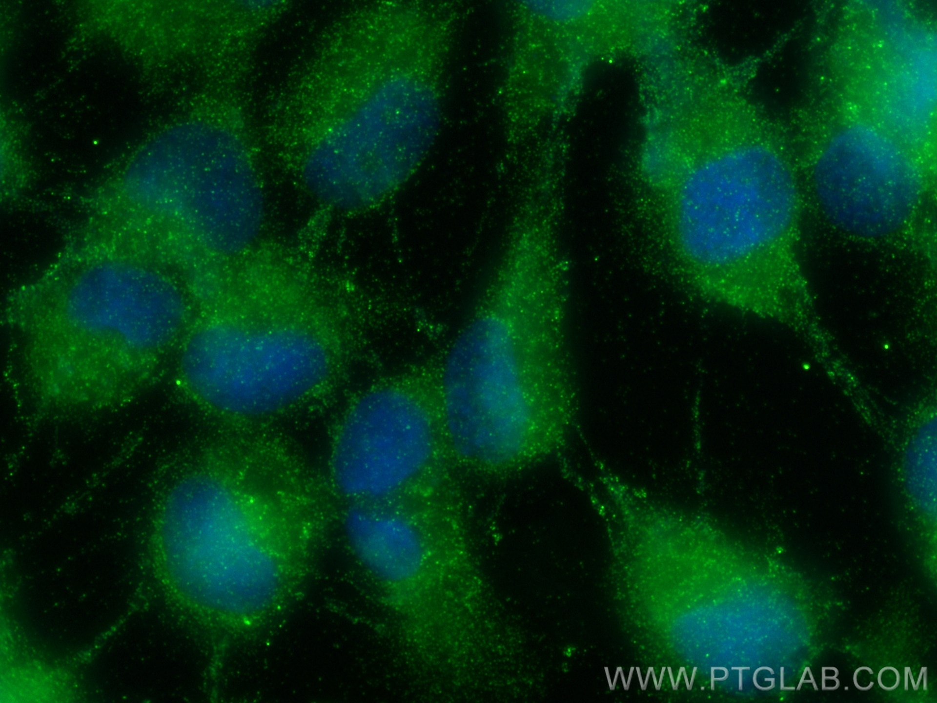 Immunofluorescence (IF) / fluorescent staining of A431 cells using ALG14 Polyclonal antibody (16207-1-AP)