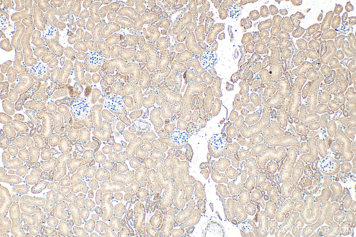 Immunohistochemistry (IHC) staining of mouse kidney tissue using ALG14 Polyclonal antibody (16207-1-AP)
