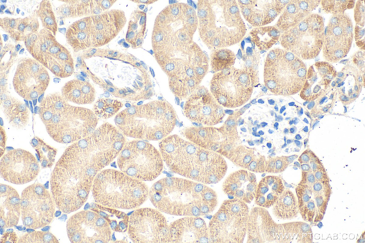 Immunohistochemistry (IHC) staining of mouse kidney tissue using ALG14 Polyclonal antibody (16207-1-AP)