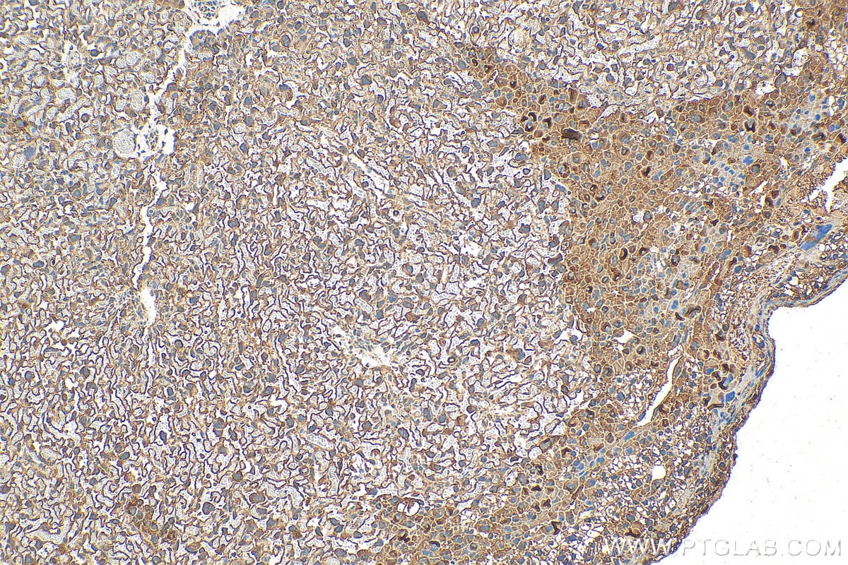 Immunohistochemistry (IHC) staining of mouse placenta tissue using ALG3 Polyclonal antibody (28084-1-AP)
