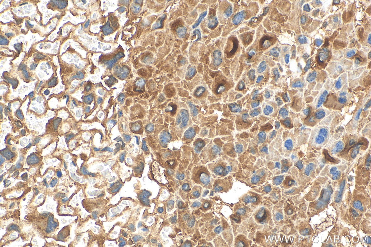 Immunohistochemistry (IHC) staining of mouse placenta tissue using ALG3 Polyclonal antibody (28084-1-AP)