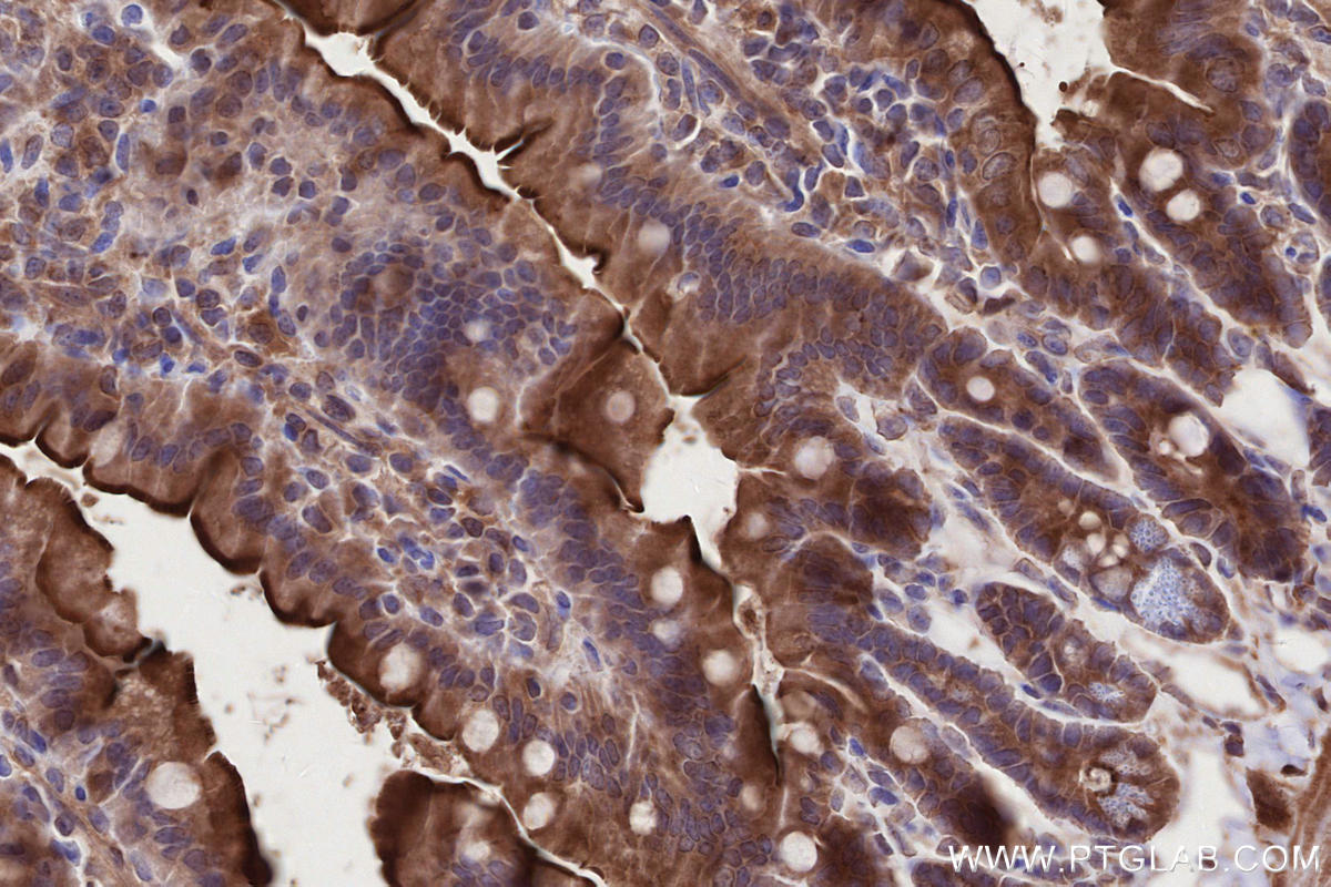 IHC staining of mouse small intestine using 28084-1-AP Immunohistochemistry (IHC) staining of mouse small intestine tissue using ALG3 Polyclonal antibody (28084-1-AP)