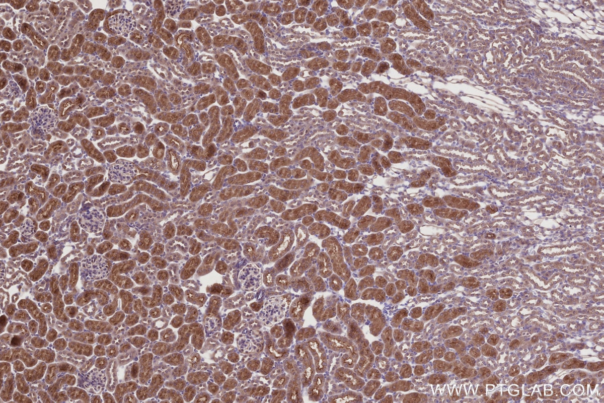 IHC staining of mouse kidney using 28084-1-AP Immunohistochemistry (IHC) staining of mouse kidney tissue using ALG3 Polyclonal antibody (28084-1-AP)
