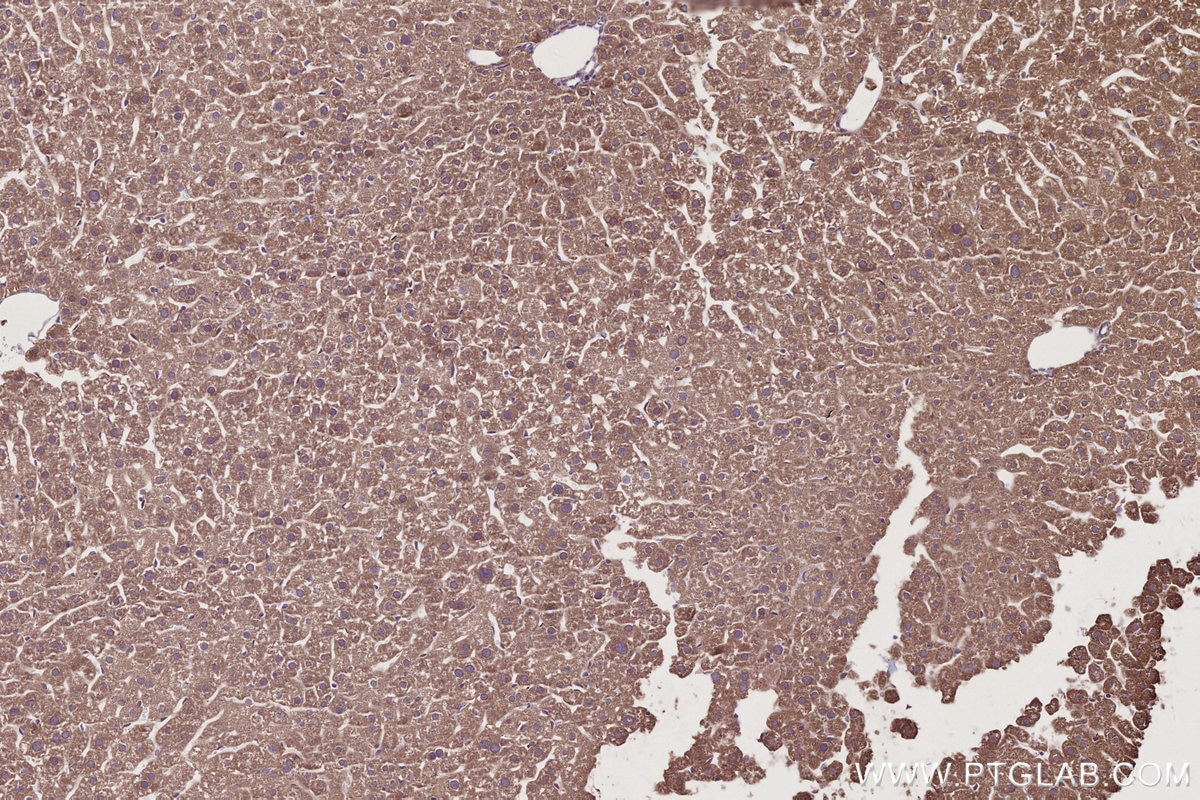 IHC staining of mouse liver using 28084-1-AP Immunohistochemistry (IHC) staining of mouse liver tissue using ALG3 Polyclonal antibody (28084-1-AP)