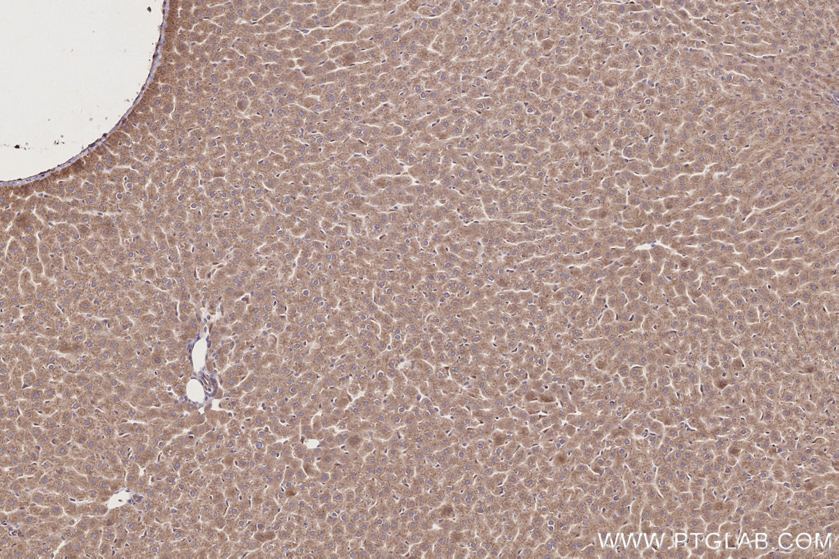 IHC staining of rat liver using 28084-1-AP Immunohistochemistry (IHC) staining of rat liver tissue using ALG3 Polyclonal antibody (28084-1-AP)