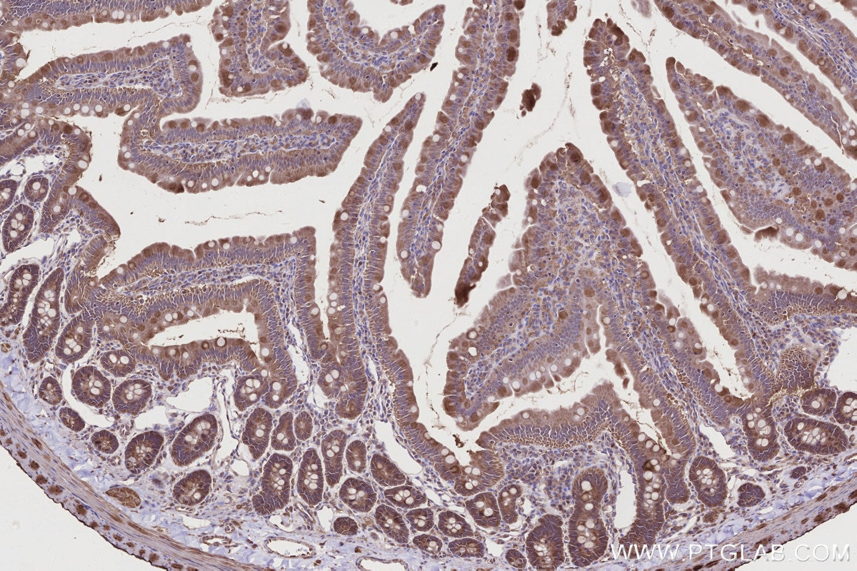 IHC staining of rat small intestine using 28084-1-AP Immunohistochemistry (IHC) staining of rat small intestine tissue using ALG3 Polyclonal antibody (28084-1-AP)