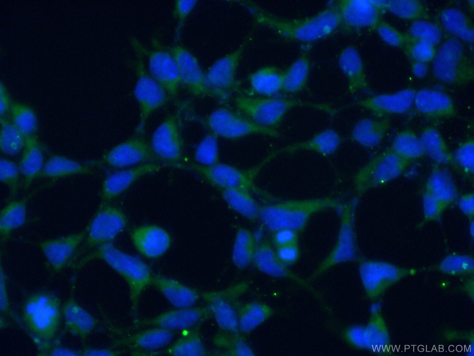 Immunofluorescence (IF) / fluorescent staining of HEK-293 cells using ALG5 Polyclonal antibody (16046-1-AP)