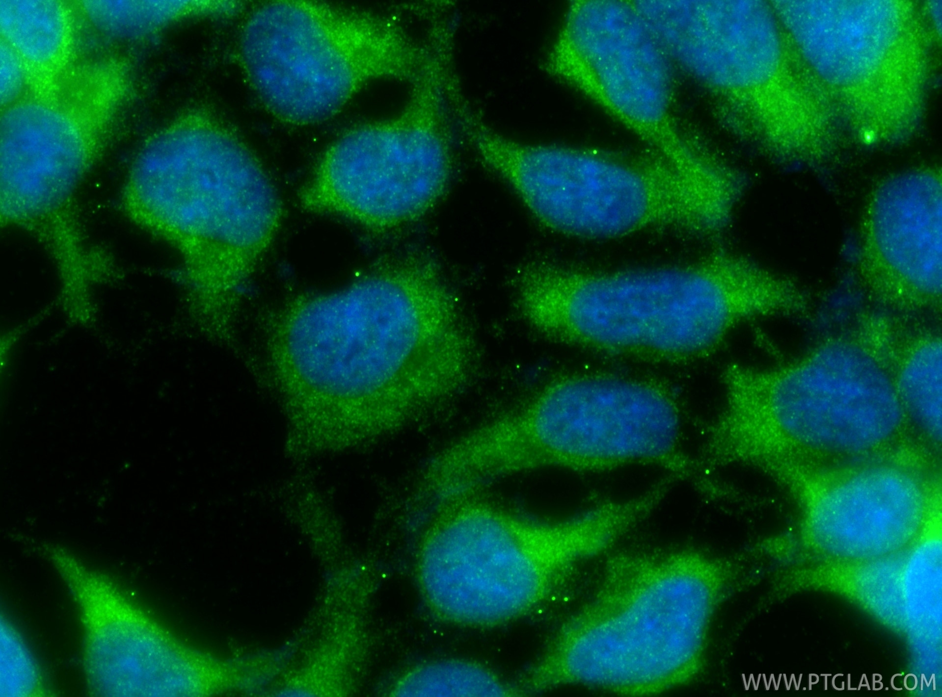 IF Staining of HEK-293 using 16046-1-AP Immunofluorescence (IF) / fluorescent staining of HEK-293 cells using ALG5 Polyclonal antibody (16046-1-AP)