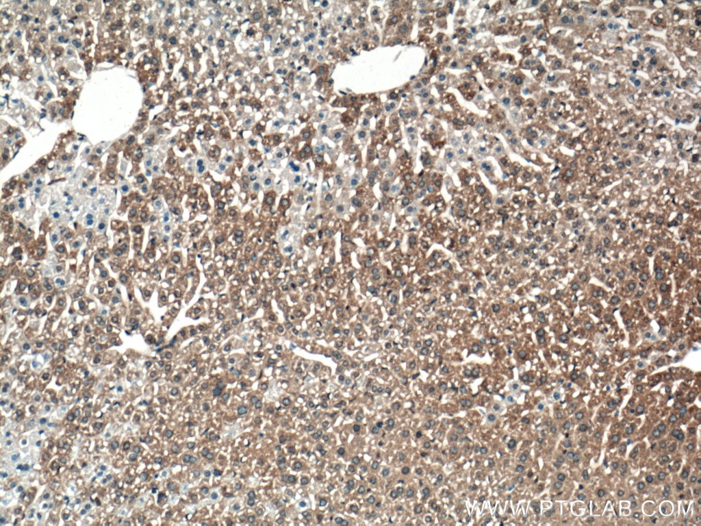 Immunohistochemistry (IHC) staining of mouse liver tissue using ALG5 Polyclonal antibody (16046-1-AP)