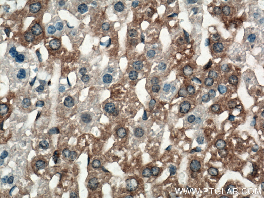 Immunohistochemistry (IHC) staining of mouse liver tissue using ALG5 Polyclonal antibody (16046-1-AP)