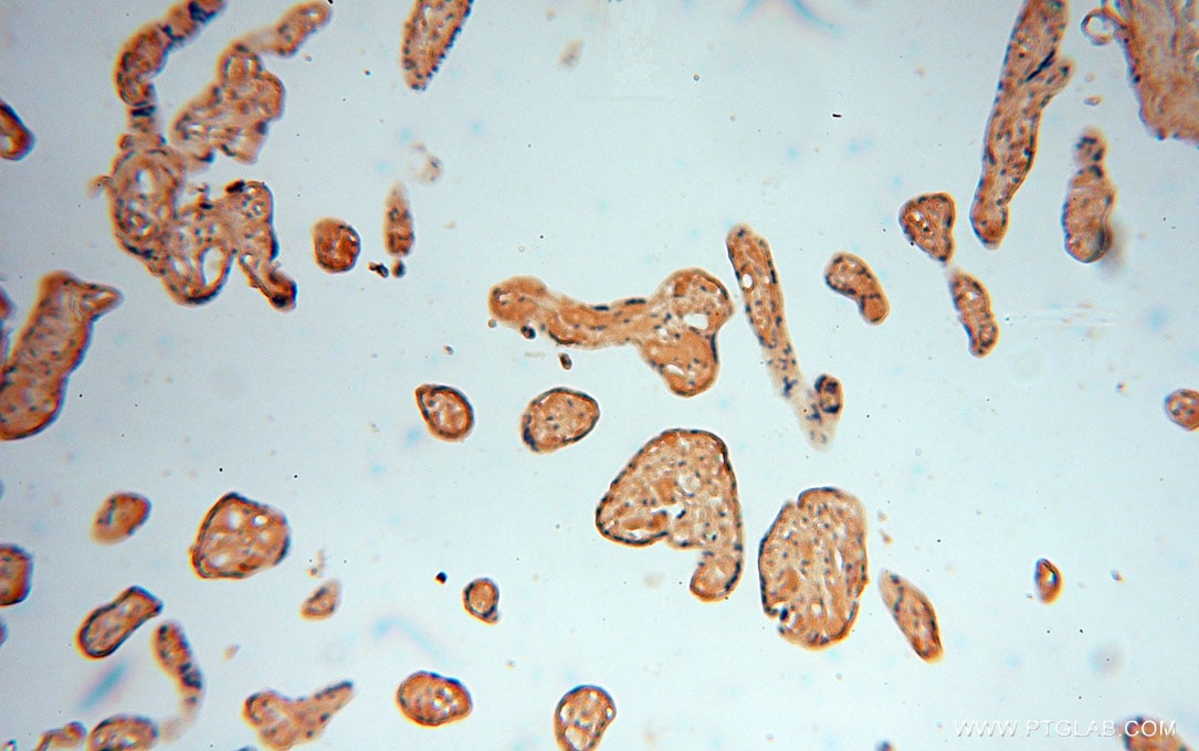 Immunohistochemistry (IHC) staining of human placenta tissue using ALG5 Polyclonal antibody (16046-1-AP)