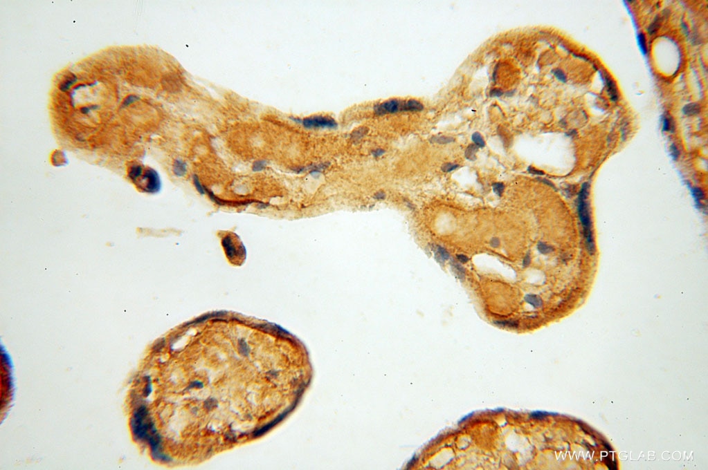 IHC staining of human placenta using 16046-1-AP