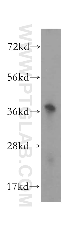 Western Blot (WB) analysis of human kidney tissue using ALG5 Polyclonal antibody (16046-1-AP)
