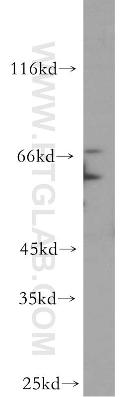 WB analysis of HeLa using 20753-1-AP