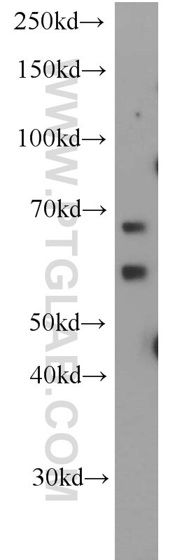 Western Blot (WB) analysis of HeLa cells using ALG6 Polyclonal antibody (20753-1-AP)