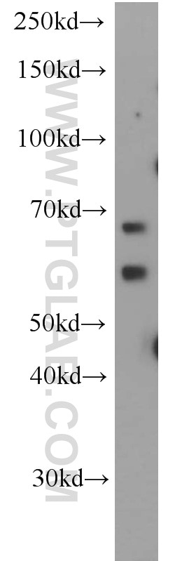 Western Blot (WB) analysis of HeLa cells using ALG6 Polyclonal antibody (20753-1-AP)