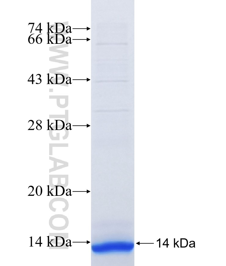 ALG8 fusion protein Ag16939 SDS-PAGE