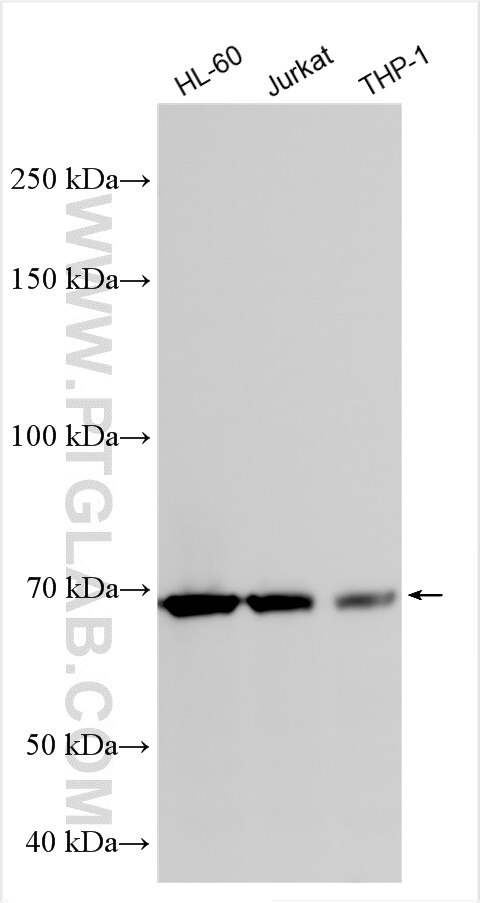 Western Blot (WB) analysis of various lysates using ALG9 Polyclonal antibody (29218-1-AP)