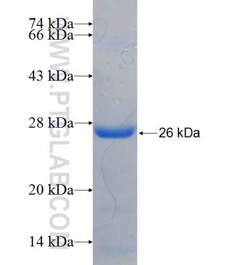ALG9 fusion protein Ag25473 SDS-PAGE